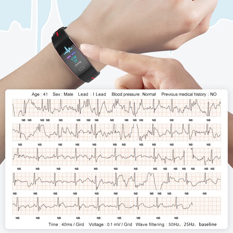 Smart Wristband – Body Temperature Monitoring, ECG+PPG, Heart Rate, Blood Pressure, Color OLED… — product image 12