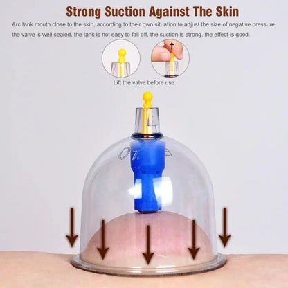 Cupping Therapy Set – Professional Vacuum Suction Cups for Chinese Medicine Physiotherapy, Massage,… — product image 10