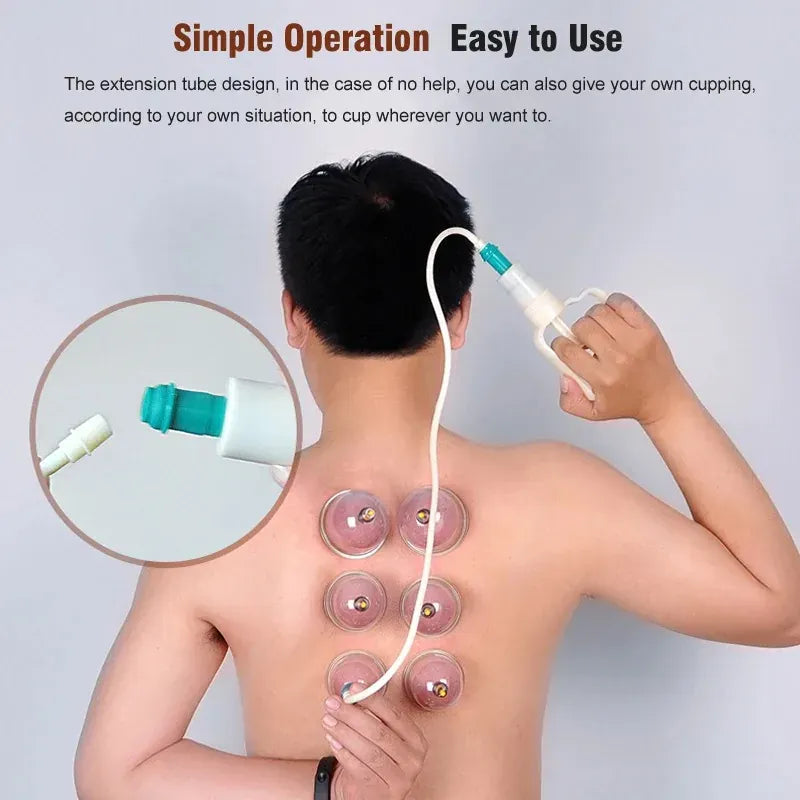 Cupping Therapy Set – Professional Vacuum Suction Cups for Chinese Medicine Physiotherapy, Massage,… — product image 12