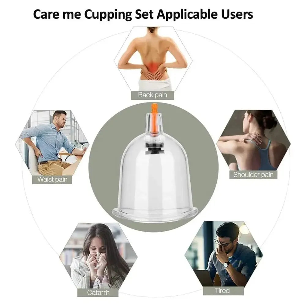 Cupping Therapy Set – Professional Vacuum Suction Cups for Chinese Medicine Physiotherapy, Massage,… — product image 6