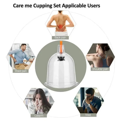 Cupping Therapy Set – Professional Vacuum Suction Cups for Chinese Medicine Physiotherapy, Massage,… — product image 6