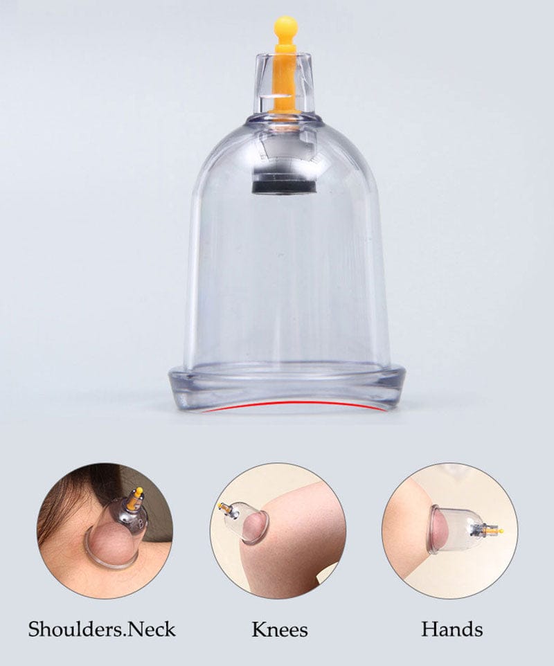 Cupping Therapy Set – Professional Vacuum Suction Cups for Chinese Medicine Physiotherapy, Massage,… — product image 7