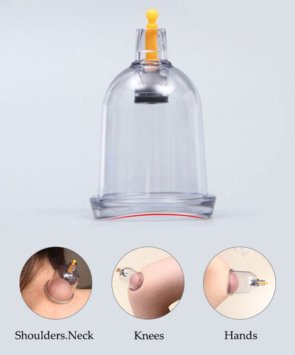 Cupping Therapy Set – Professional Vacuum Suction Cups for Chinese Medicine Physiotherapy, Massage,… — product image 7