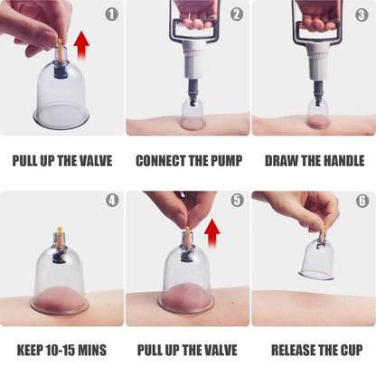 Cupping Therapy Set – Professional Vacuum Suction Cups for Chinese Medicine Physiotherapy, Massage,… — product image 9