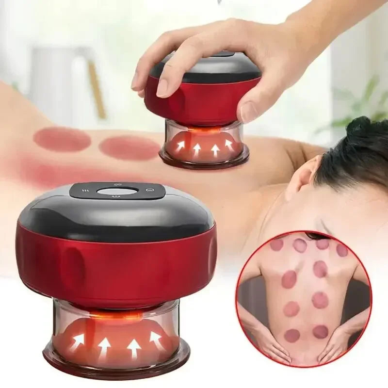 Electric Cupping Therapy Set – Rechargeable Gua Sha Massager, 12-Level Vacuum Suction, Fat Burning &… — product image 1