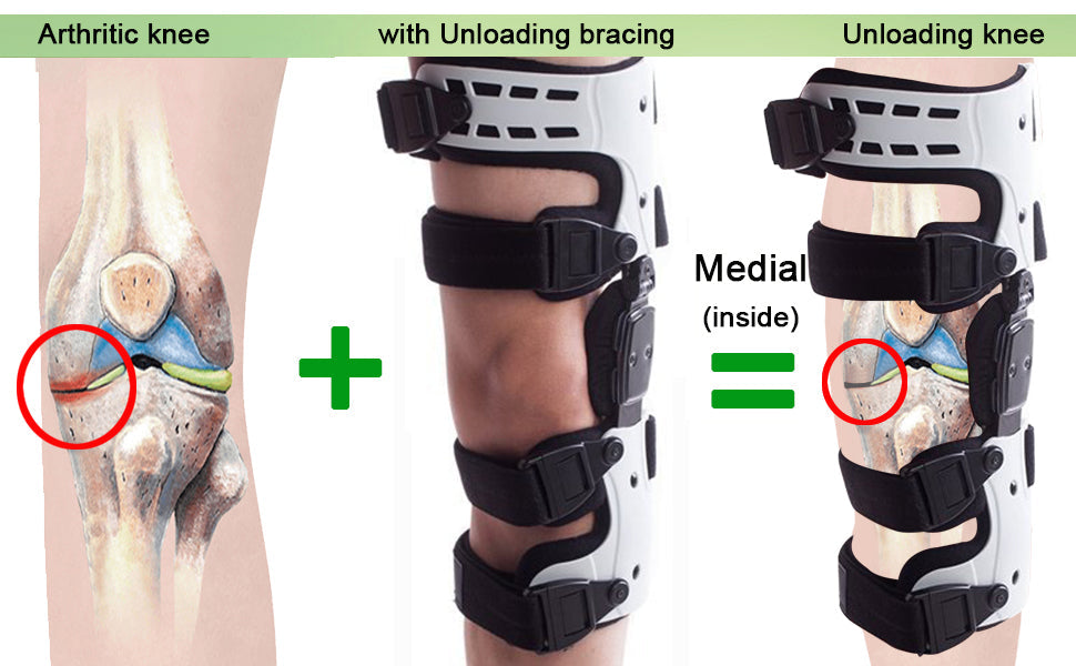 OA Unloader Knee Brace – Adjustable Hinged Support with Medial Offloading and Range of Motion Control — product image 11
