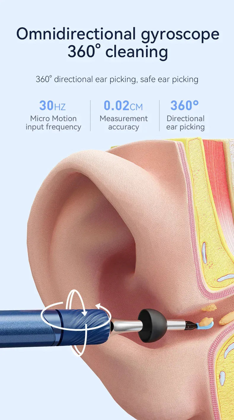 3-in-1 Wi-Fi Visual Ear Cleaning Tool – Camera Ear Pick with Tweezers, 12MP HD Imaging, Rechargeable… — product image 12
