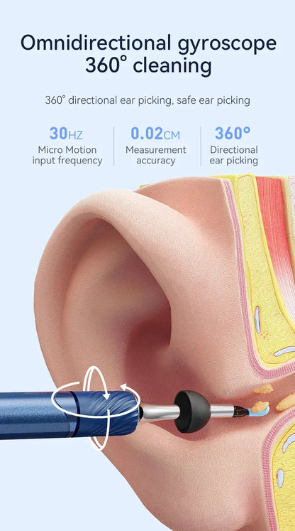 3-in-1 Wi-Fi Visual Ear Cleaning Tool – Camera Ear Pick with Tweezers, 12MP HD Imaging, Rechargeable… — product image 12