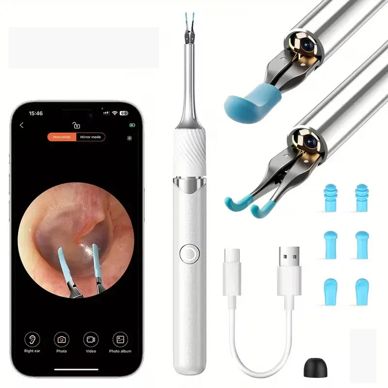 3-in-1 Wi-Fi Visual Ear Cleaning Tool – Camera Ear Pick with Tweezers, 12MP HD Imaging, Rechargeable… — product image 4