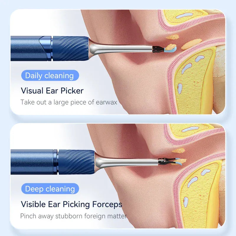 3-in-1 Wi-Fi Visual Ear Cleaning Tool – Camera Ear Pick with Tweezers, 12MP HD Imaging, Rechargeable… — product image 6