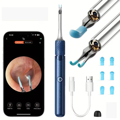 3-in-1 Wi-Fi Visual Ear Cleaning Tool – Camera Ear Pick with Tweezers, 12MP HD Imaging, Rechargeable… — product image 3