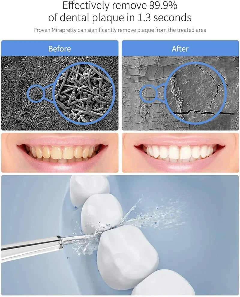 600ML Oral Irrigator – Multifunction Electric Water Flosser with 10 Modes and IPX7 Waterproof Design — product image 3