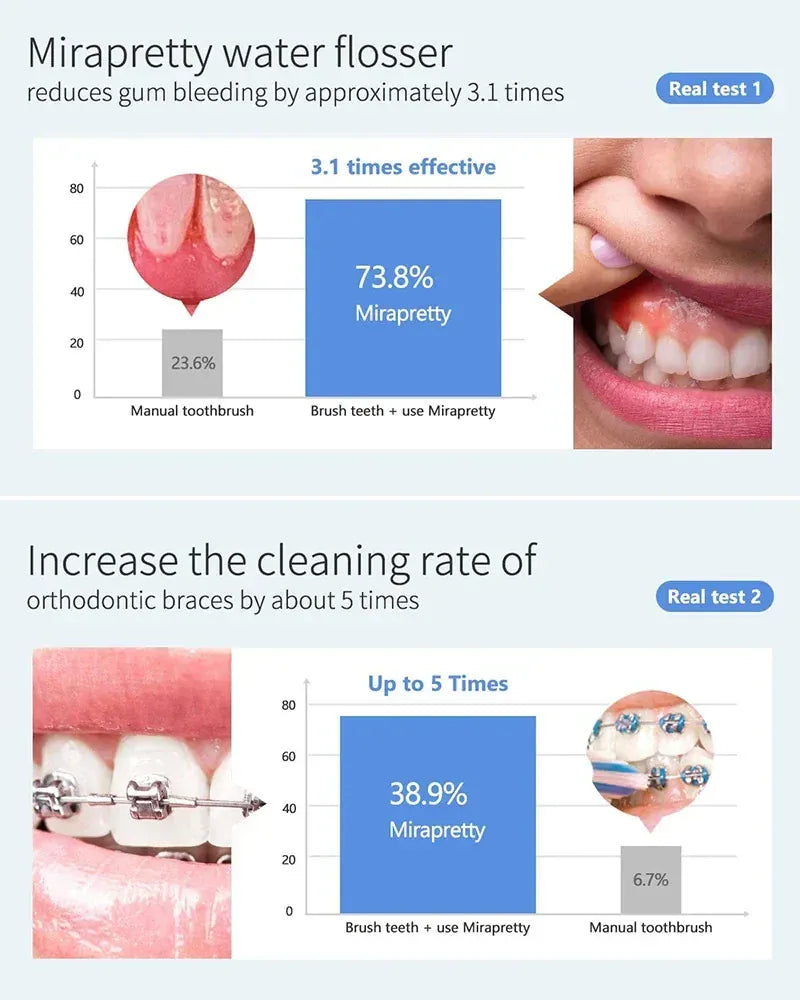 600ML Oral Irrigator – Multifunction Electric Water Flosser with 10 Modes and IPX7 Waterproof Design — product image 4