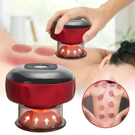 Electric Cupping Therapy Set – Rechargeable Gua Sha Massager, 12-Level Vacuum Suction, Fat Burning &… — product image 1