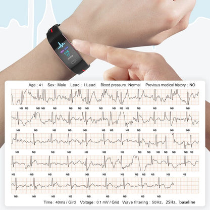 Smart Wristband – Body Temperature Monitoring, ECG+PPG, Heart Rate, Blood Pressure, Color OLED… — product image 12