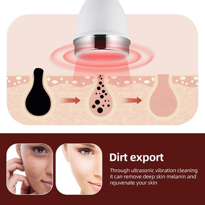 Ultrasound Beauty Machine – High Frequency Face and Eye Massager for Skin Care, Facial Lifting, and… — product image 5